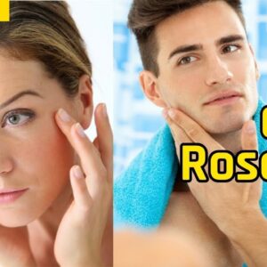 Cure Rosacea and Rhinophyma Subliminal Affirmations