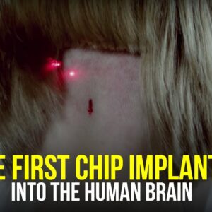 "This Could Be a Tragedy For Humanity" | The First Brain Chip Implant